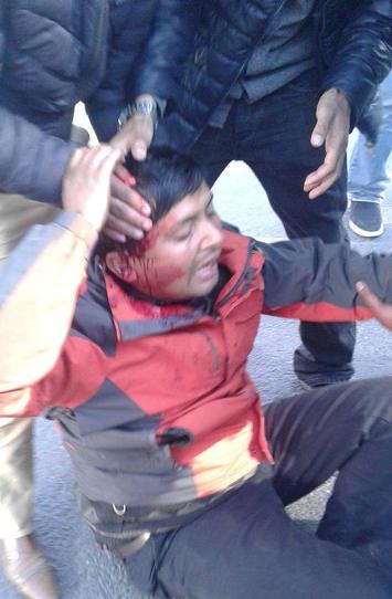 विद्यार्थी आन्दोलनमा प्रहरी हस्तक्षेप  